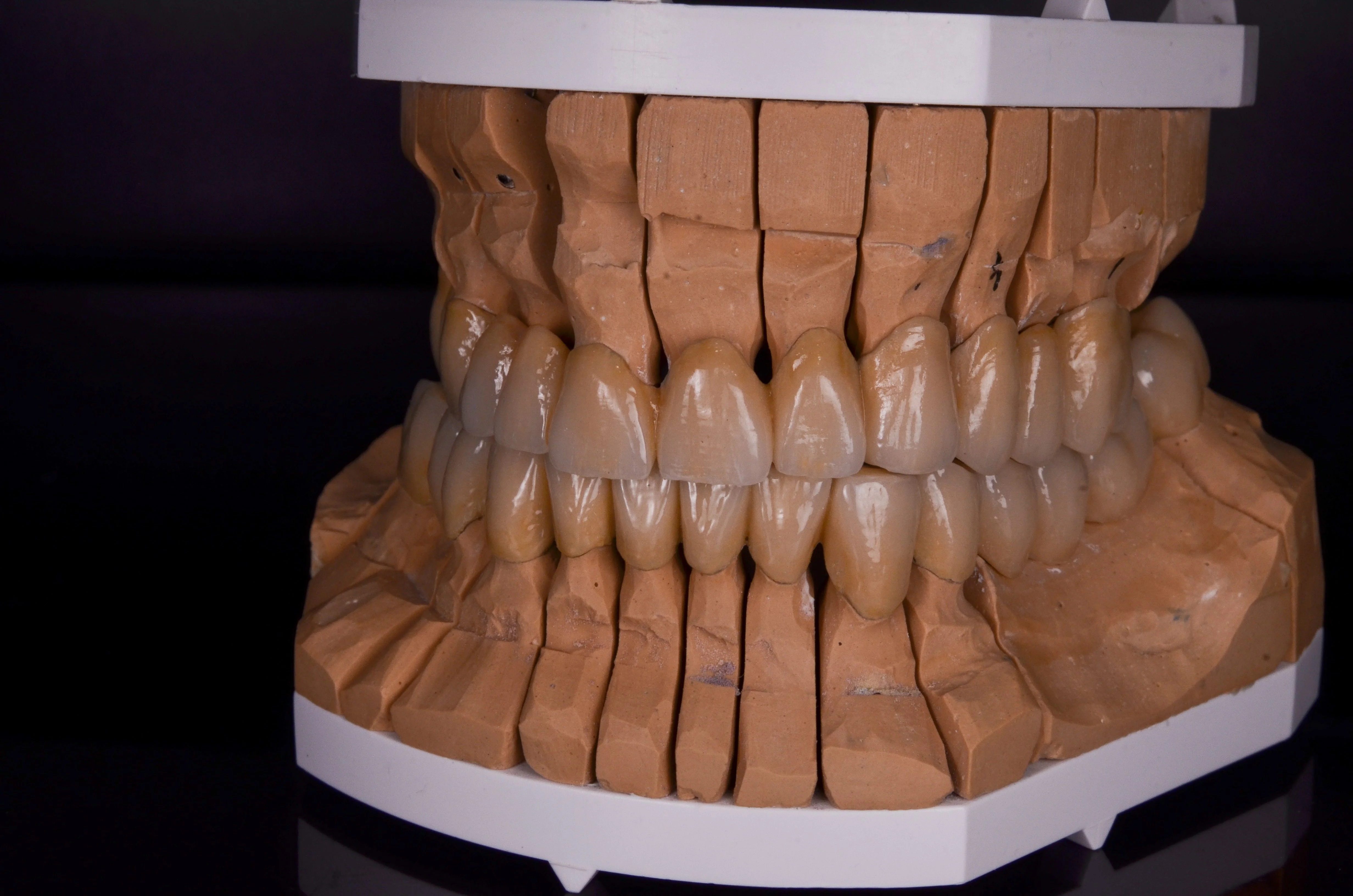 dentální 3D model